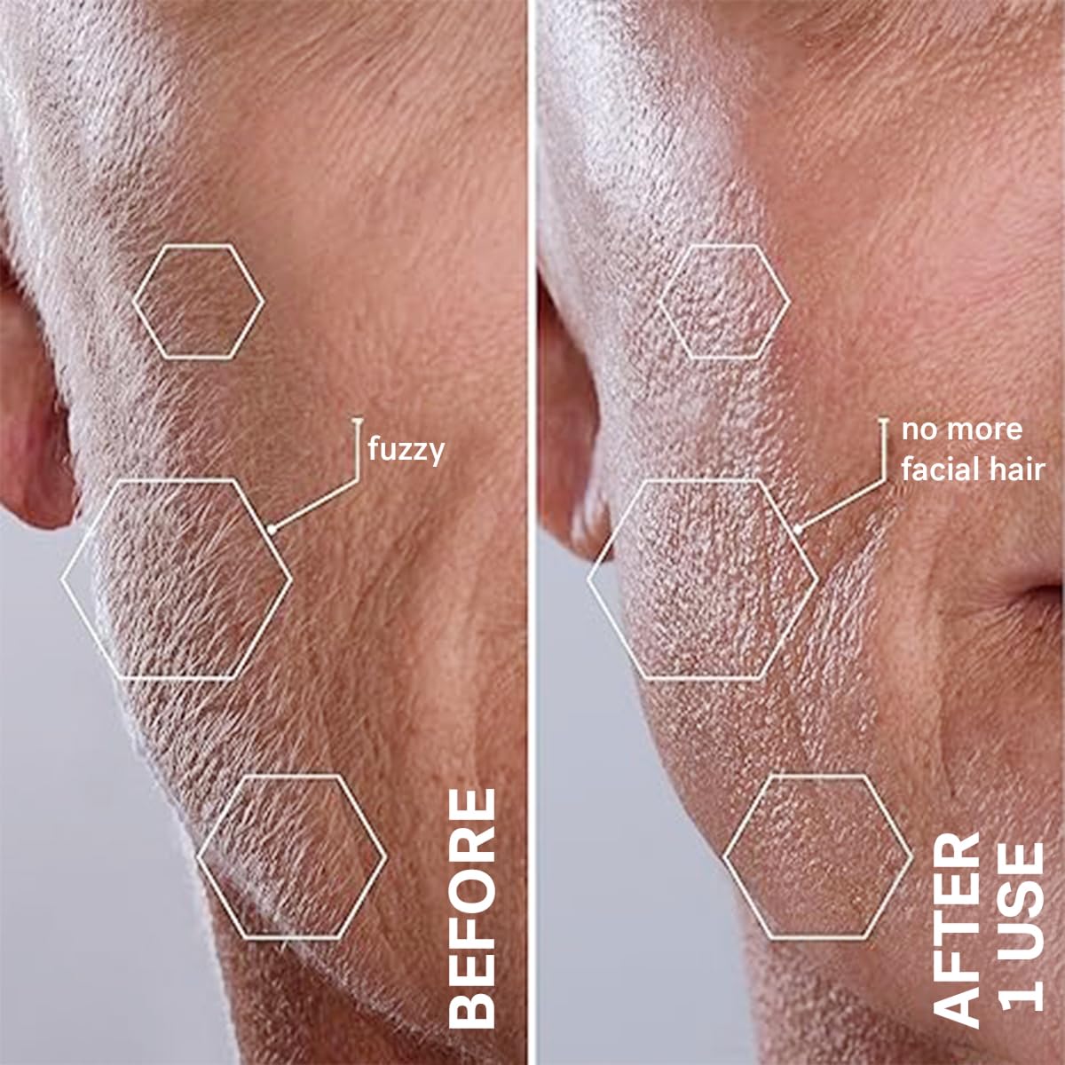 Michael Todd Beauty Sonicsmooth Dermaplane Razor para la cara de la...