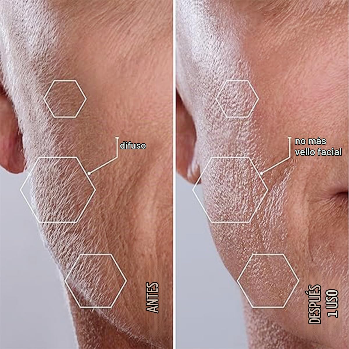 Michael Todd Beauty Sonicsmooth Dermaplane Razor para la cara de la...