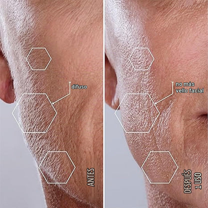 Michael Todd Beauty Sonicsmooth Dermaplane Razor para la cara de la...