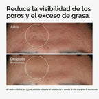 The Ordinary Niacinamida 10% + Zinc 1%, sérum suavizante para piele...