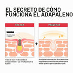 Neutrogena Adapalene Gel 0.1% Tratamiento para el acné, 1.6 oz | Tó...