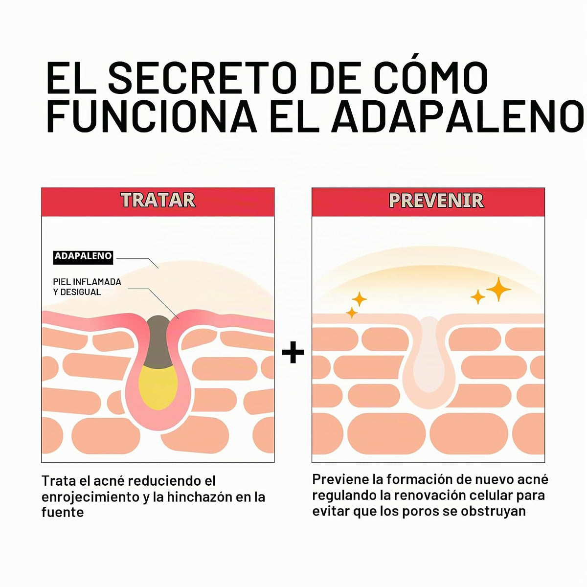 Neutrogena Adapalene Gel 0.1% Tratamiento para el acné, 1.6 oz | Tó...