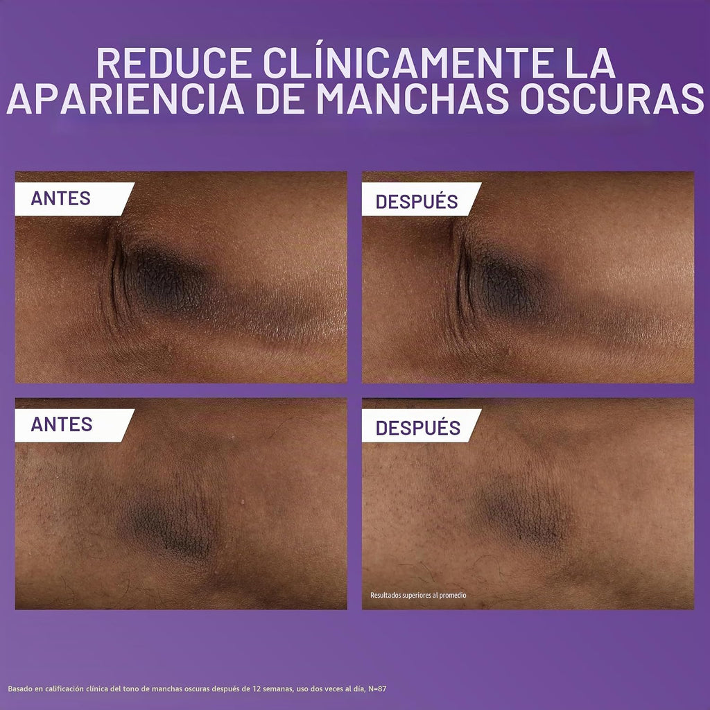 CeraVe Loción corporal iluminadora de vitamina C, cuidado de la pie...