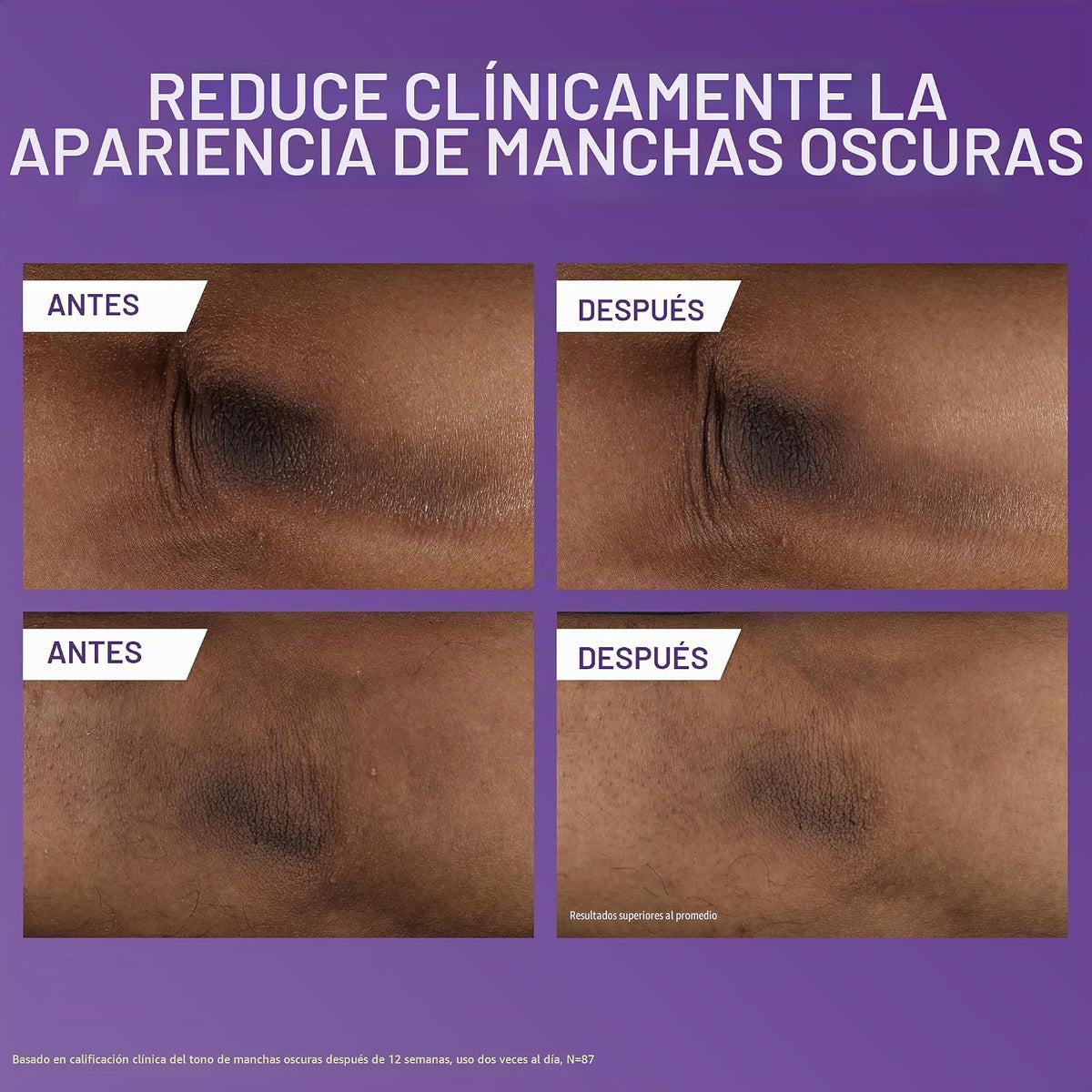 CeraVe Loción corporal iluminadora de vitamina C, cuidado de la pie...