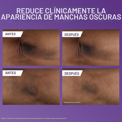 CeraVe Loción corporal iluminadora de vitamina C, cuidado de la pie...