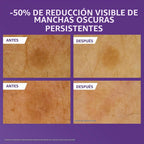 CeraVe Loción corporal iluminadora de vitamina C, cuidado de la pie...