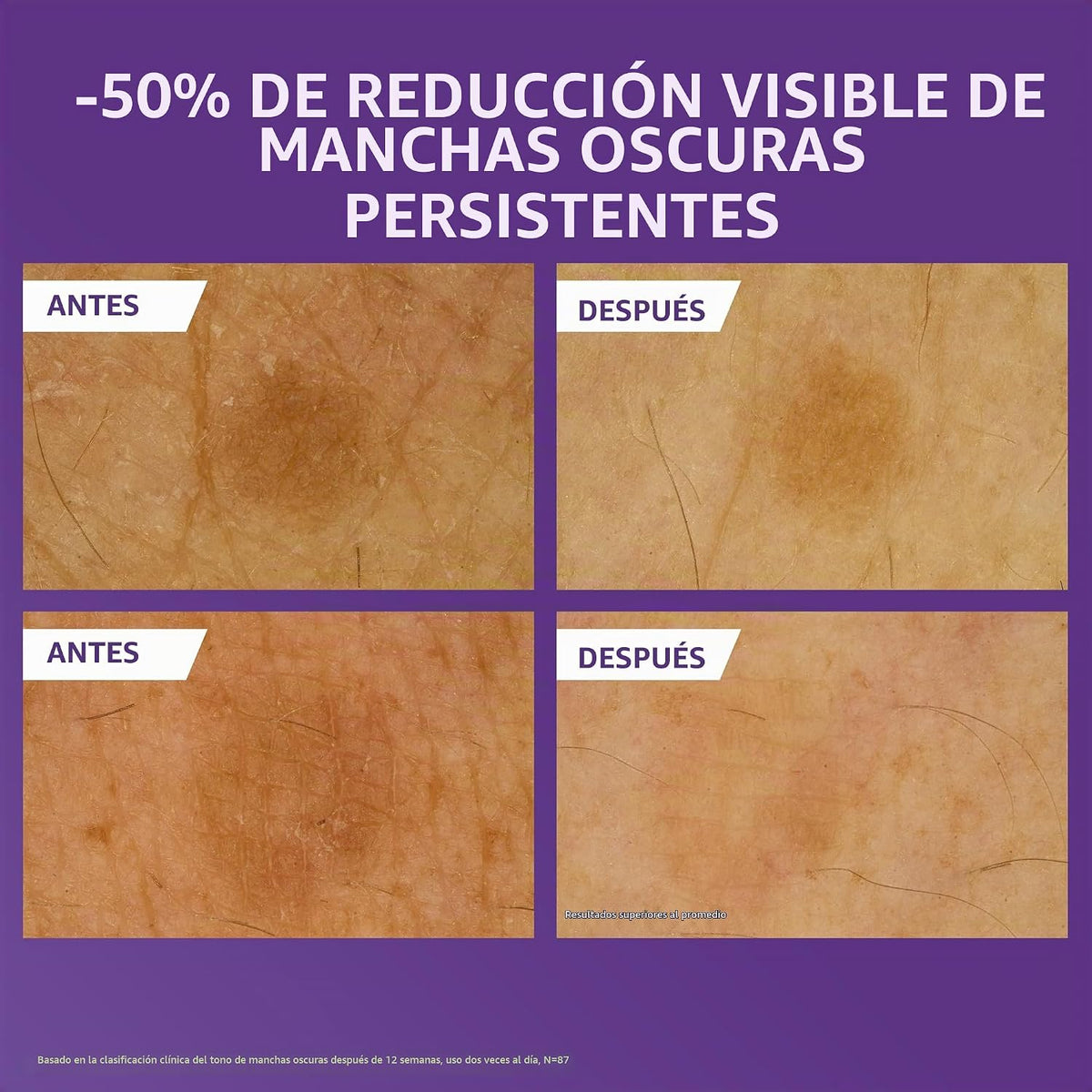 CeraVe Loción corporal iluminadora de vitamina C, cuidado de la pie...