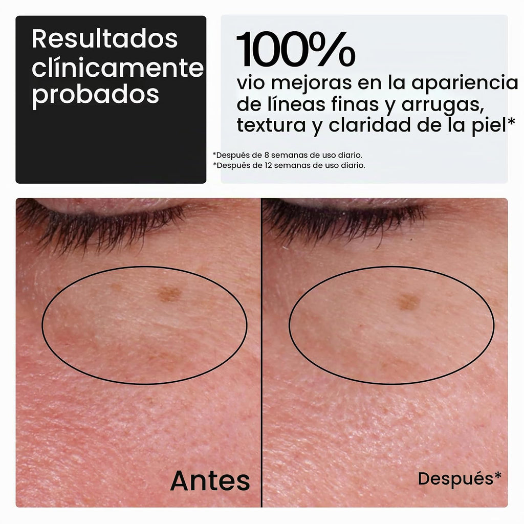 Neutrogena - Hidratante facial Rapid Wrinkle Repair Retinol, sin fr...