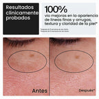 Neutrogena - Hidratante facial Rapid Wrinkle Repair Retinol, sin fr...