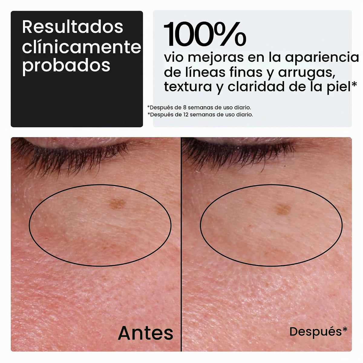 Neutrogena - Hidratante facial Rapid Wrinkle Repair Retinol, sin fr...