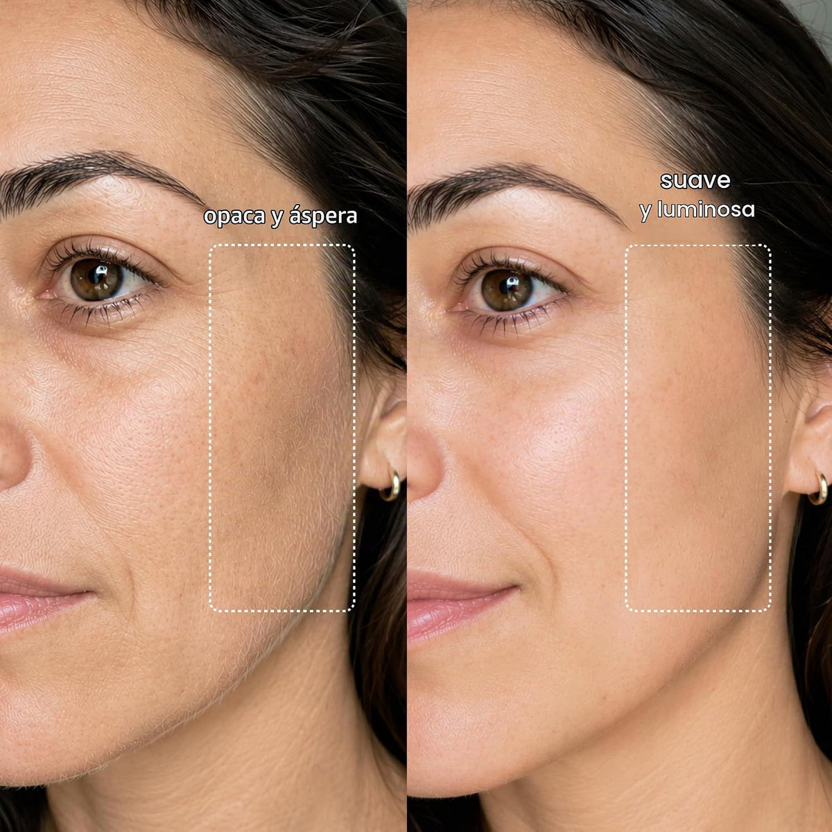 MICHAEL TODD Beauty Sonicsmooth Dermaplane maquinilla de afeitar pa...