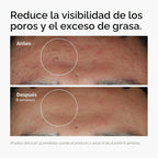 The Ordinary Set favorito de suero: ácido hialurónico 2% + B5, niac...