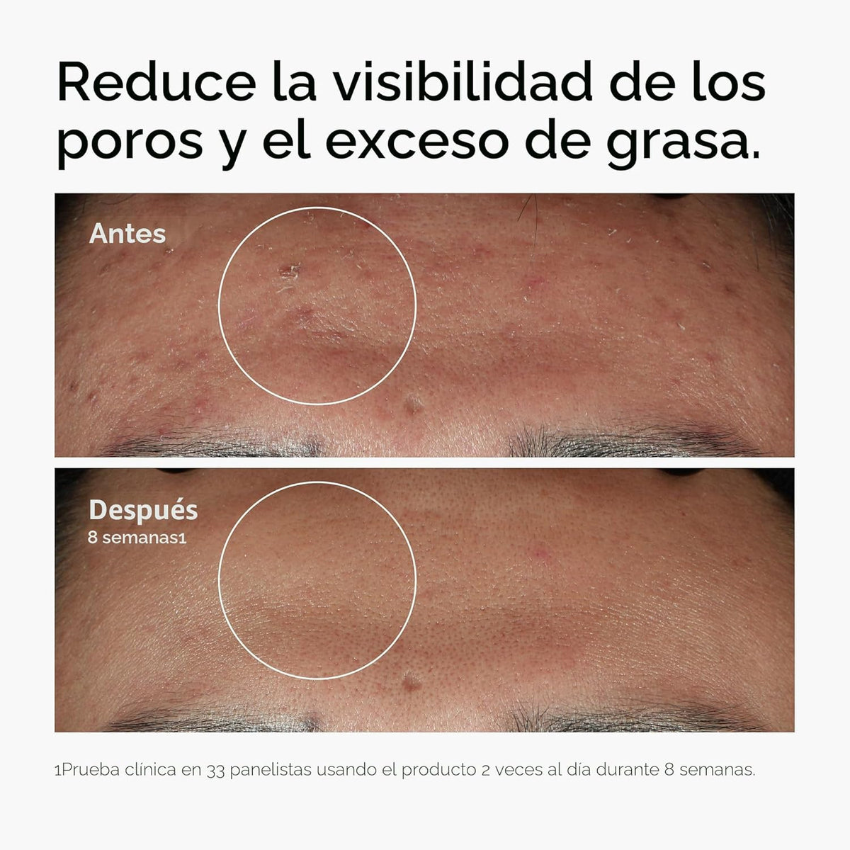 The Ordinary Set favorito de suero: ácido hialurónico 2% + B5, niac...