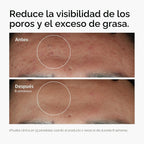 The Ordinary Niacinamida 10% + Zinc 1%, sérum suavizante para piele...