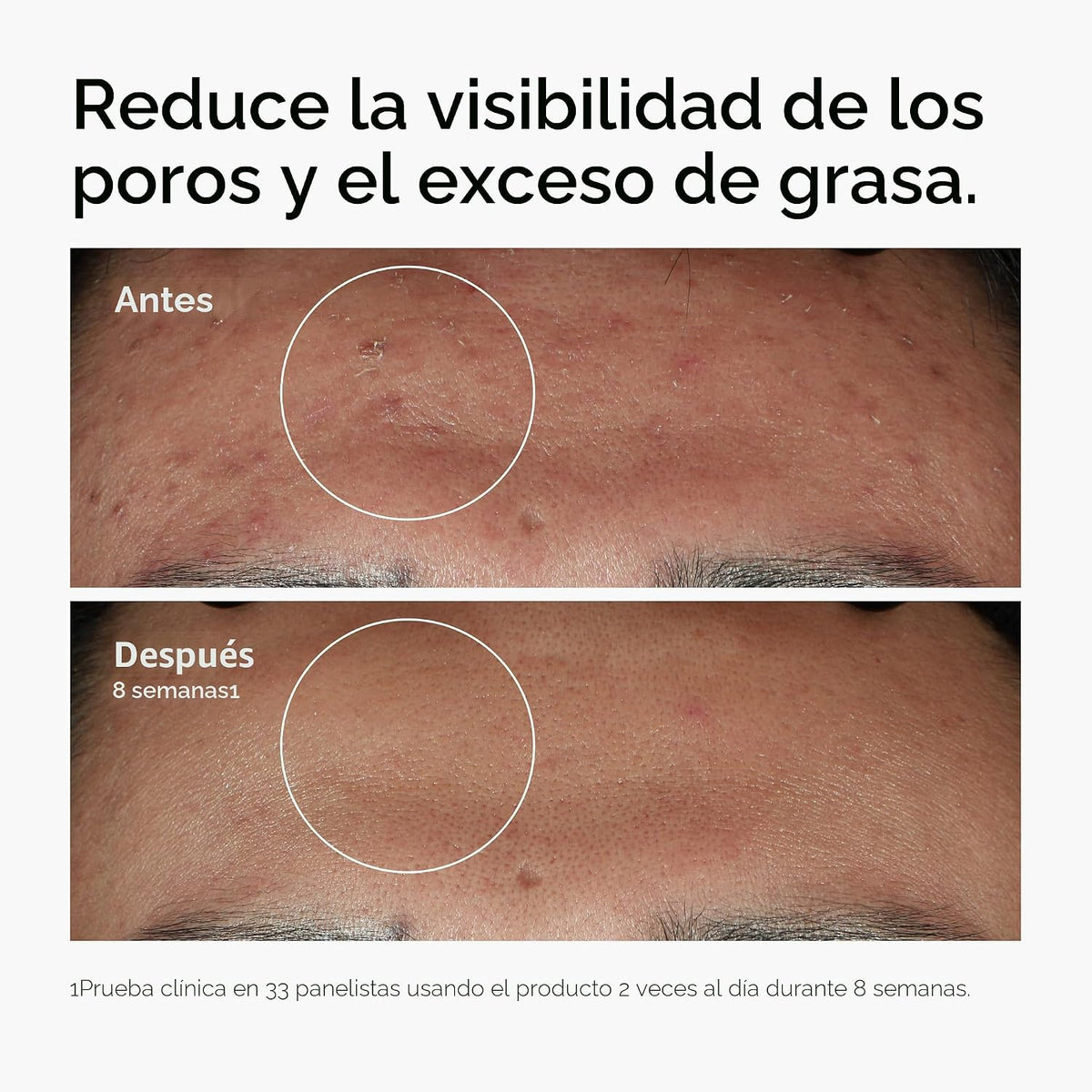 The Ordinary Niacinamida 10% + Zinc 1%, sérum suavizante para piele...