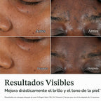 Neutrogena Collagen Bank 15%, suero facial con vitamina C, 0.5 fl....