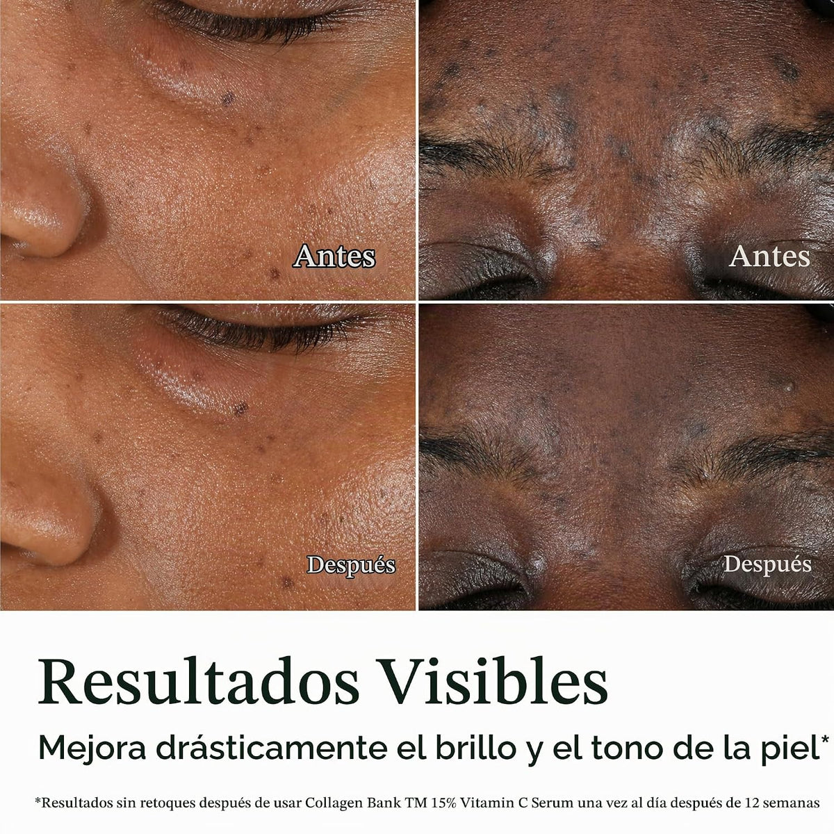 Neutrogena Collagen Bank 15%, suero facial con vitamina C, 0.5 fl....