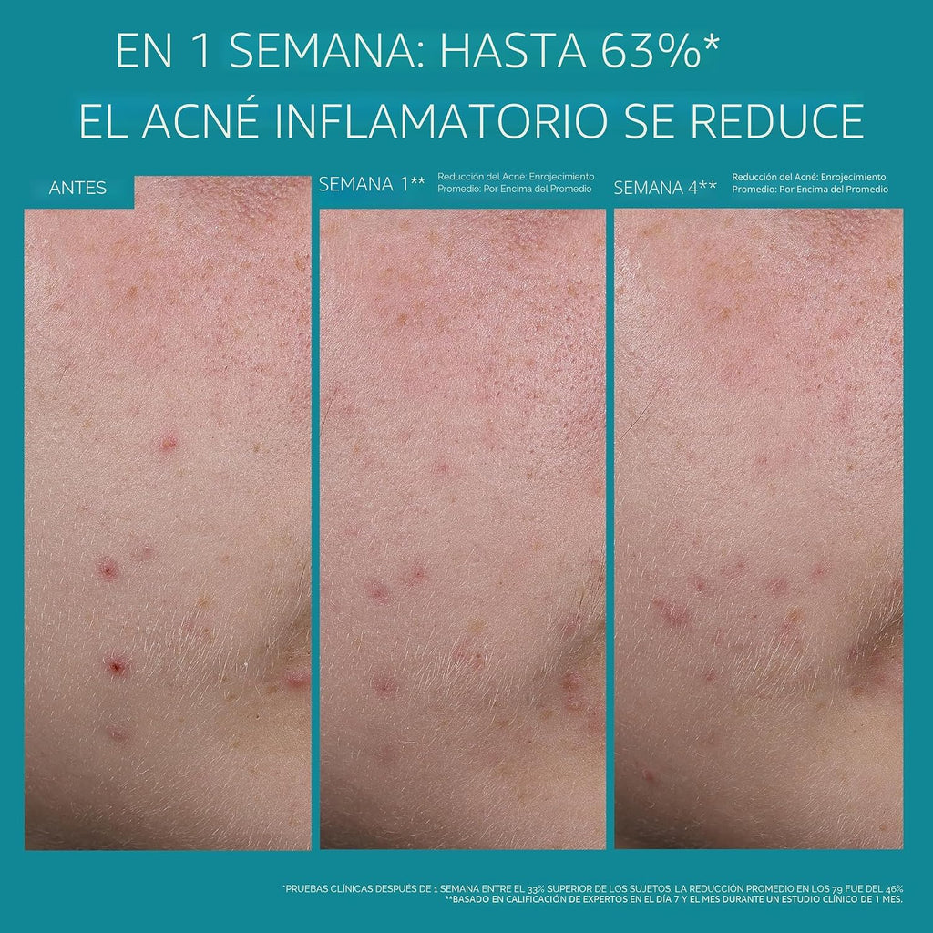 La Roche-Posay Effaclar BPO Multi-Target Acne Treatment, Benzoyl Pe...