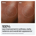 Neutrogena Hydro Boost - Suero rejuvenecedor de ácido hialurónico,...